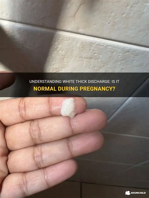 thick white discharge but negative pregnancy test|white discharge early pregnancy.